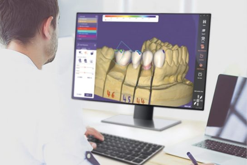 CAD/CAM Teknolojisi
