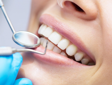 Ağız ve Diş Sağlığı Check-Up