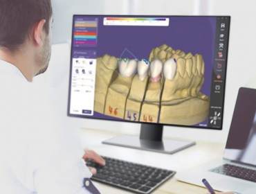 CAD/CAM Teknolojisi